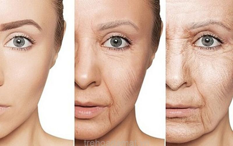 Những làn da và đối tượng cần thực hiện Ultherapy