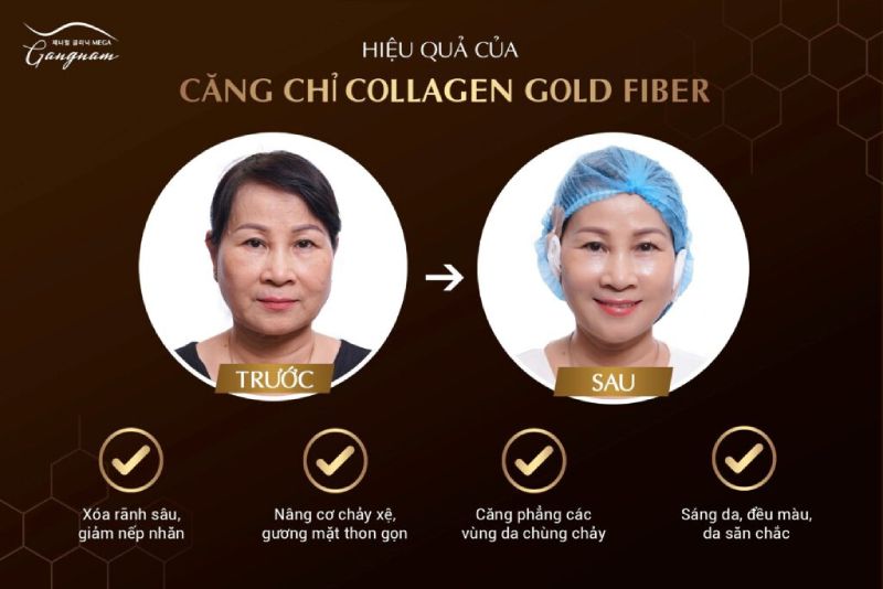 hieu-qua-cang-chi-collagen-gold-fiber-tai-mega-gangnam-compressed