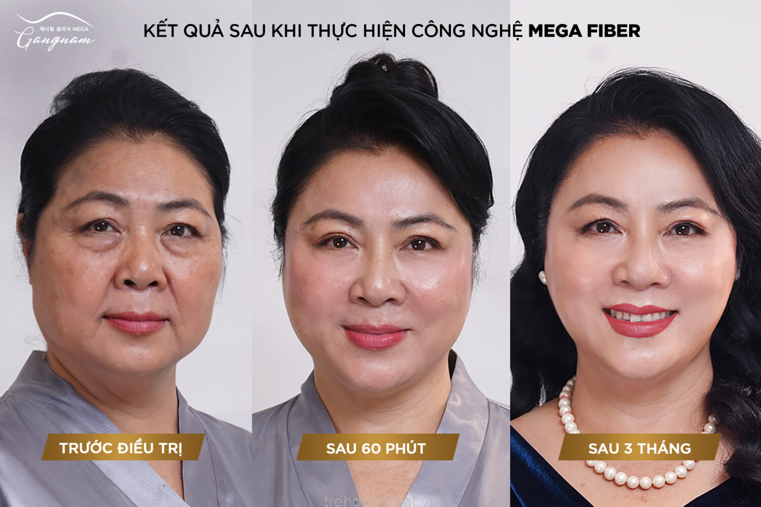 khach-hang-tre-hoa-da-bang-collagen