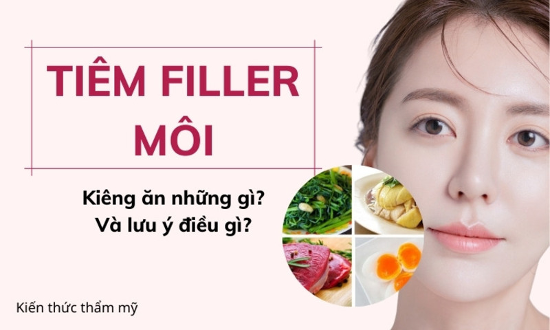 tiem-filler-moi-can-chu-y-gi