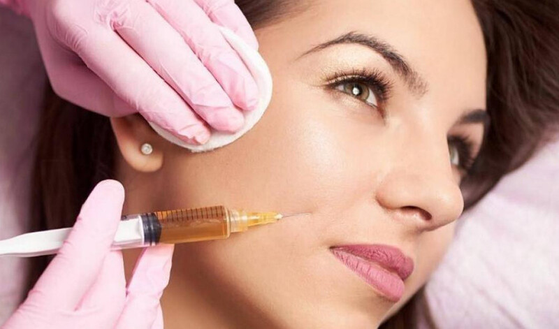 Tiêm Filler Rãnh Cười Có Nguy Hiểm Không