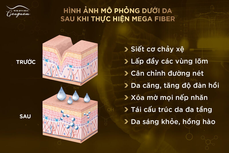 hinh-anh-mo-phong-sau-khi-cang-chi-collagen-nang-mui-co-anh-uong-gi-khong