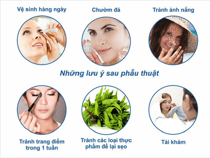 Nhung-luu-y-sau-tieu-phau-nang-cung-may