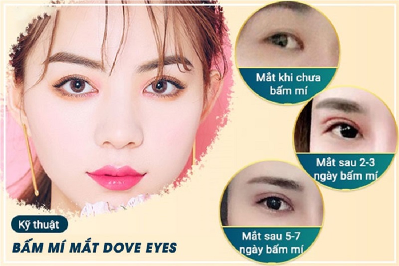 bam-mi-mat-dove-eyes-la-gi