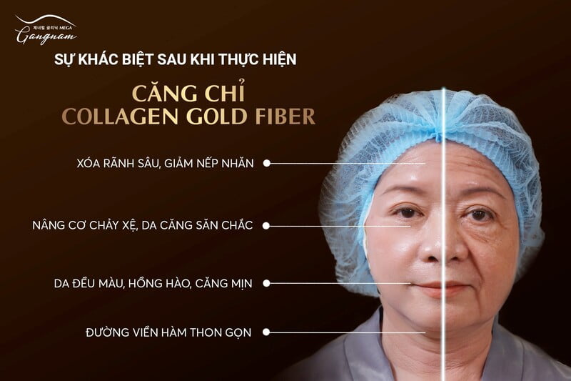 nang-mui-cang-chi-collagen-gold-fiber-dem-lai-dang-mui-tu-nhien